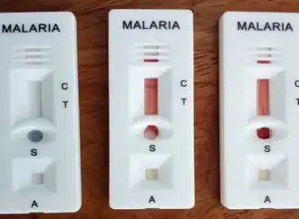 Impact of malaria prevalence in Nigeria